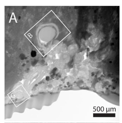 Transmission Electron Microscopy of Organic Nanoglobules in a Carbonaceous Chondrite