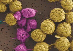 Colorful image of ball-like consortium of cells. The balls look like yellow, pink, and green balls of twine.
