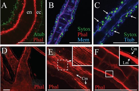 Fig 2. Morphology of the polyp oral tentacle in Aurelia sp.1. All scale bars represent 50 μm. (A) Longitudinal section of tentacle, revealing the morphology and distribution of ectodermal (ec) and endodermal (en) cells. (B) A similar image showing the distribution of nuclei in the tentacle. Note the row of large, vacuolated cells in the endoderm. (C) Longitudinal section demonstrating how anti-Ttub can be used to identify cnidocytes. Examples where enlarged cells (caused by the presence of the cnidocyte capsule) are co-localized with crescent-shaped nuclei are labeled with arrows. (D) Phalloidin staining at the base of a tentacle. (E) A partial stack of confocal images, revealing the circumferential myofibrils (Cm) underneath the longitudinal musculature of the epitheliomuscular cells. (F) Circumfirential fibers in E, along with electron microscopy not shown document circumferential contration and a previously unrecognized extensional motor apparatus.