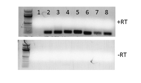 Figure 1. Acaryochloris recA genes are transcribed.

After induction with rhamnose, RNA was extracted from E. coli strains carrying plasmids with different copies of recA. Lane 1 is a rec-lacking control strain. Lanes 2 and 3 are  strains containing the native E. coli recA on the chromosome or a plasmid, respectively. Lane 4 is  a strain containing the recA from the cyanobacterium Cyanothece PCC 7425, and lanes 5-8 are strains containing different duplicated recA copies from Acaryochloris. Bands in the top panel show the RT-PCR products indicative of gene expression The bottom panel is a quality control screen for genomic DNA contamination in the samples, with none detected.