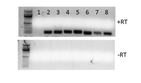 Figure 1. Acaryochloris recA genes are transcribed.

After induction with rhamnose, RNA was extracted from E. coli strains carrying plasmids with different copies of recA. Lane 1 is a rec-lacking control strain. Lanes 2 and 3 are  strains containing the native E. coli recA on the chromosome or a plasmid, respectively. Lane 4 is  a strain containing the recA from the cyanobacterium Cyanothece PCC 7425, and lanes 5-8 are strains containing different duplicated recA copies from Acaryochloris. Bands in the top panel show the RT-PCR products indicative of gene expression The bottom panel is a quality control screen for genomic DNA contamination in the samples, with none detected.