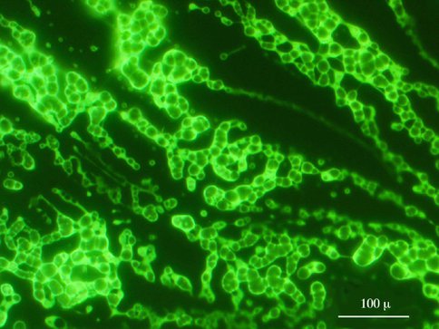 Figure 1. The self-assembly of amphiphiles occurs when molecules with both hydrophilic and hydrophobic regions arrange themselves into a minimum-energy configuration, such as a spherical phospholipid bilayer vesicle.