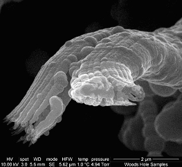 Figure 4. SEM (left) and TEM (right) image of branching tube morphology. Cells are no longer attached, but have been observed at the ends of the tubes using light/fluorescence microscopy (not shown).