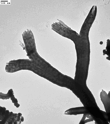 Figure 5. SEM (left) and TEM (right) image of branching tube morphology. Cells are no longer attached, but have been observed at the ends of the tubes using light/fluorescence microscopy (not shown).