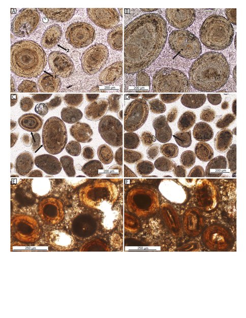 Photomicrograph of Ooids