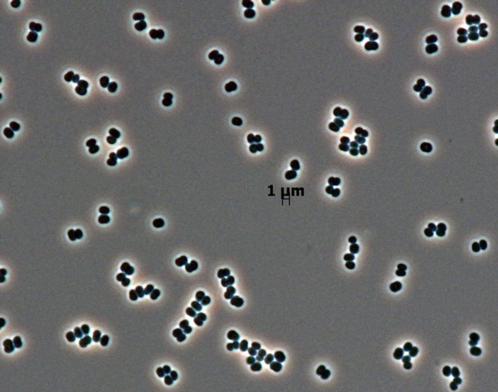 Cells of tersicoccus phoenicis, a rare microbe found in clean rooms in South America and Florida. The latest microscopic technology can isolate individual microbes from their colonies, improving the search for life on other worlds in the future.  Image credit: NASA