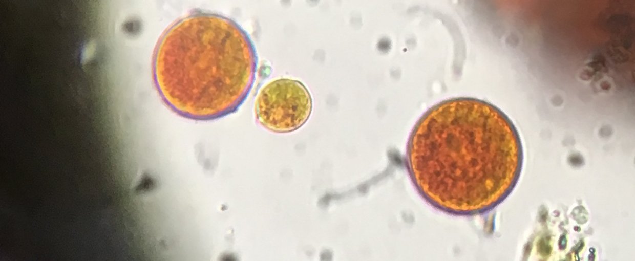 Microscopy image showing three cells in focus. They are round in shape and filled with smaller vesicles. Two are large and red in color. The smaller cell in the middle is greenish with red tints throughout.