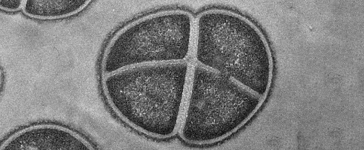 A transmission electron micrograph shows Deinococcus radiodurans, a bacterium that is resistant to extreme levels of ionizing radiation and desiccation. Strains were isolated from sediments collected from under a nuclear waste storage tank.