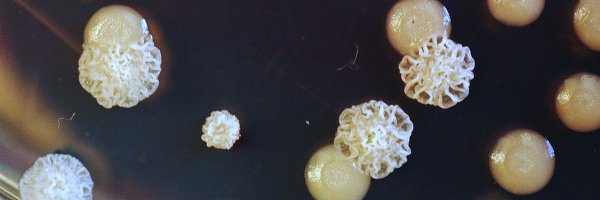 An example of a mixed biofilm under a microscope.