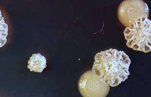 An example of a mixed biofilm under a microscope.