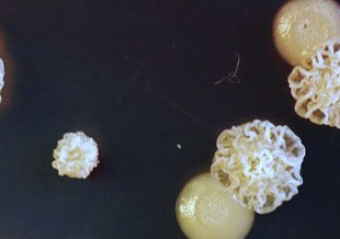 An example of a mixed biofilm under a microscope.