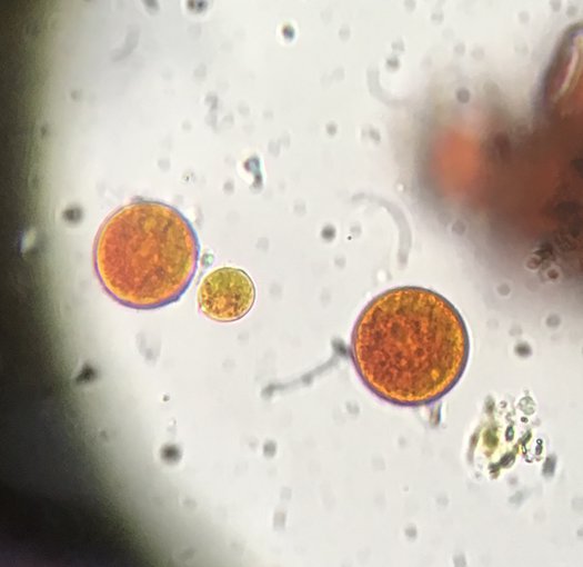 Microscopy image showing three cells in focus. They are round in shape and filled with smaller vesicles. Two are large and red in color. The smaller cell in the middle is greenish with red tints throughout.