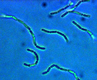 An image of Lactobacillus, which is often used in probiotics.