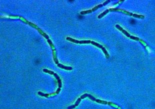 An image of Lactobacillus, which is often used in probiotics.
