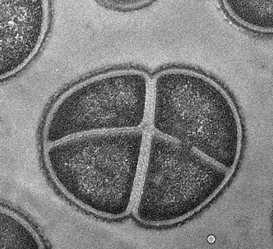 A transmission electron micrograph shows Deinococcus radiodurans, a bacterium that is resistant to extreme levels of ionizing radiation and desiccation. Strains were isolated from sediments collected from under a nuclear waste storage tank.