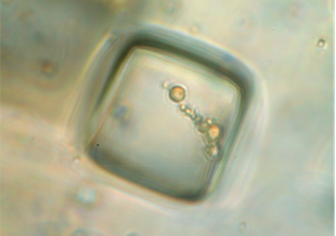 Microscopic image of a cube-like inclusion. Inside the cube, a group of cells can be seen clumped together.