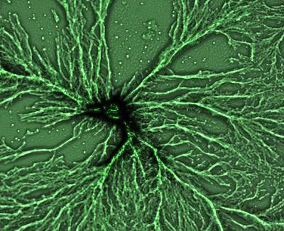 Cells of Dictyostelium purpureum, a common soil microbe, streaming to form a multicellular fruiting body. Credit: Natasha Mehdiabadi/Rice University