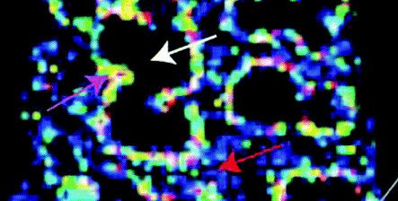 Example of visualizing molecular distributions of biomaterials using mass spectrometry imaging.