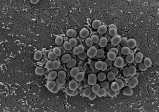 A bacterium that causes deadly cerebrospinal meningitis, <em>Neisseria meningitidis</em>, uses type IV pili to help it erode and cross the human blood brain barrier, a structure that surrounds the brain tissue and ordinarily protects it from invasion.