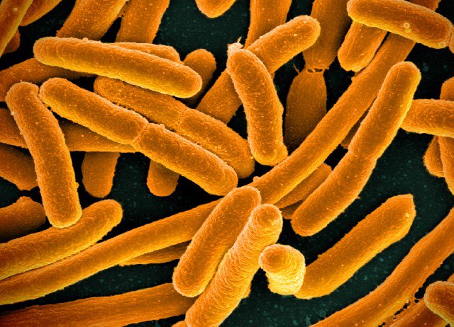 The researchers examined the biological processes of E.coli, a common bacteria.