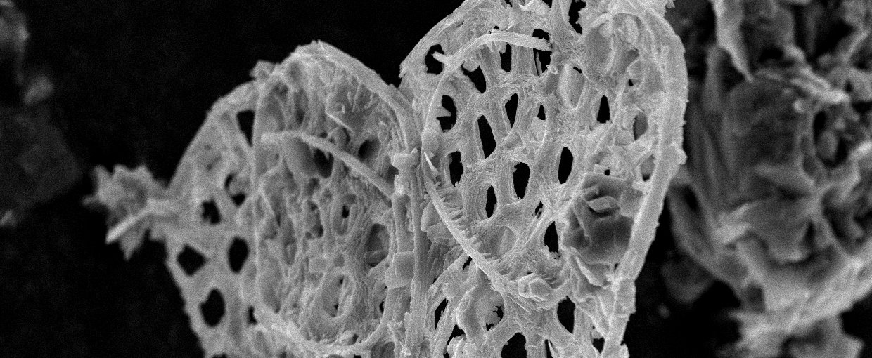 SEM image of a cluster of biomineralized ASM fossils from Mount Slipper. Fossils are found by dissolving carbonate rocks in weak acid. These structures likely acted as armor, with many plates of the same type surrounding a single cell.