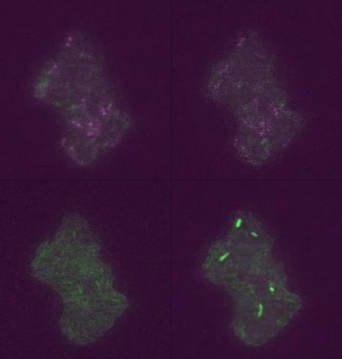 Twinkling transposons in live cells.