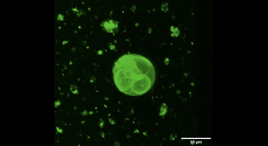 On a field of black, fluorescent green flecks of material can be seen. The largest object is in the center of the frame and looks like a bunch of glowing green circles drawn and stacked together inside a large sphere.