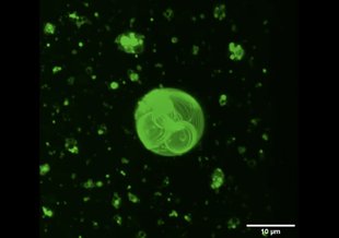 On a field of black, fluorescent green flecks of material can be seen. The largest object is in the center of the frame and looks like a bunch of glowing green circles drawn and stacked together inside a large sphere.