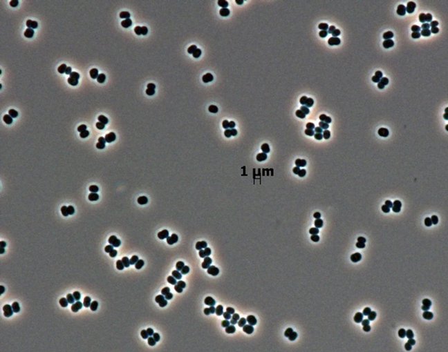Cells of tersicoccus phoenicis, a rare microbe found in clean rooms in South America and Florida. The latest microscopic technology can isolate individual microbes from their colonies, improving the search for life on other worlds in the future. 