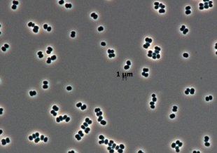 Cells of tersicoccus phoenicis, a rare microbe found in clean rooms in South America and Florida. The latest microscopic technology can isolate individual microbes from their colonies, improving the search for life on other worlds in the future. 