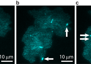 A bacterial colony showing individual cells undergoing transposable element events, resulting in blue fluorescence. Images are shown at (a) t = 0, (b) t = 40 min, and (c) t = 60 min, with arrows indicating newly occurring events in each image. Image court
