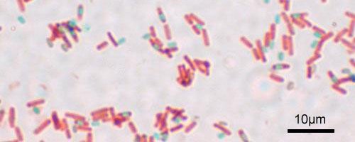 A stained preparation of cells showing endospores as green and the vegetative cell as red.