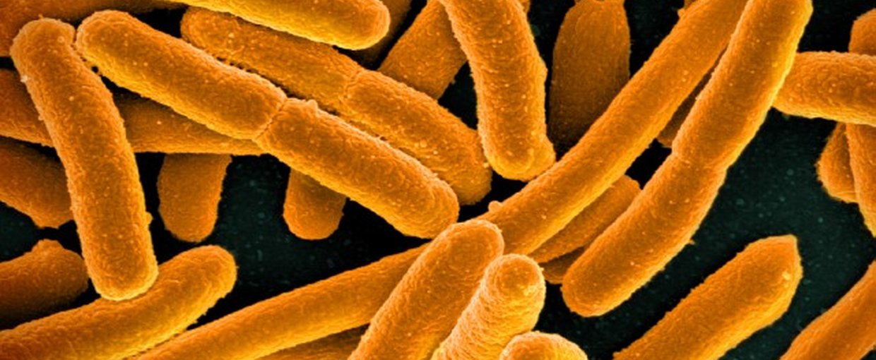 E.coli, a common bacteria.