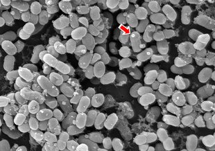 Scientists at MIT documented the first extracellular vesicles produced by ocean microbes. The arrow in the photo above points to one of these spherical vesicles in this scanning electron micrograph s